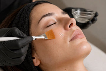 tratamiento peeling químico facial