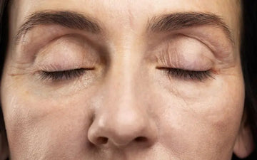 Qué le pasa a tu rostro si te tratas con ozempic, Wegovy o Mounjaro