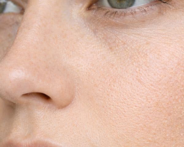 Tratamiento Facial Piel Deshidratada Barcelona