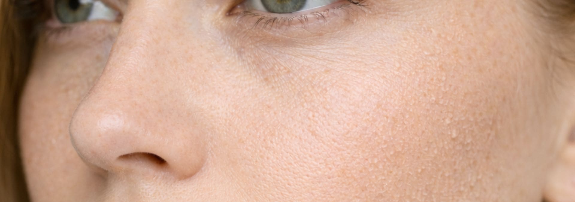 Tratamiento Facial Piel Deshidratada Barcelonaslider_item_cP4KXz