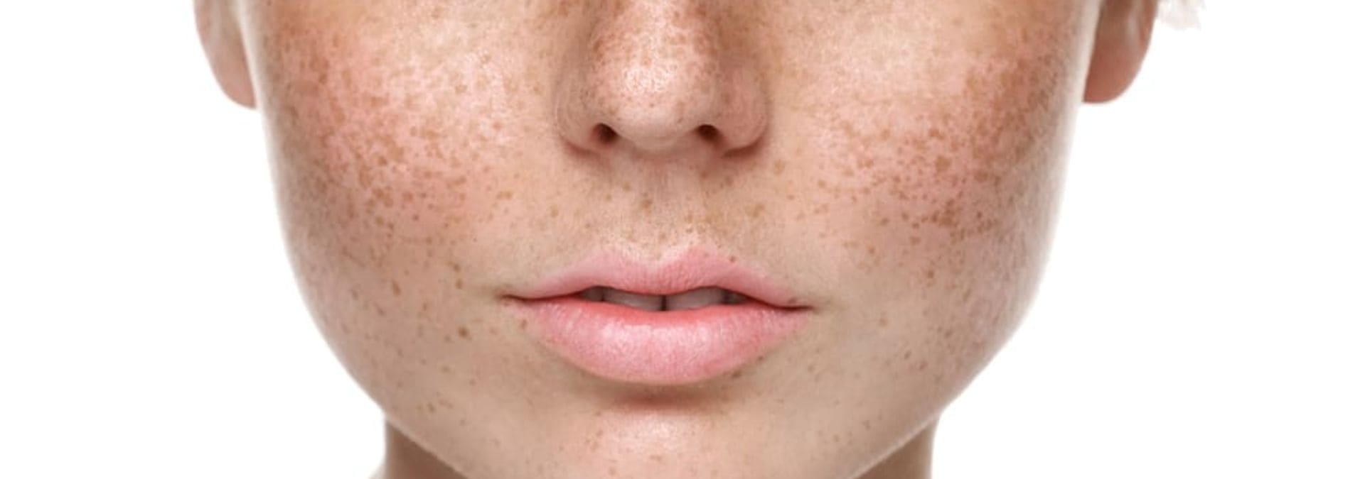 Tratamiento facial piel seca barcelonaslider_item_cP4KXz